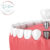 Logo del gruppo Full Mouth Dental Implantation at DoctorPrem: Restoring Your Smile, Confidence, and Quality of Life